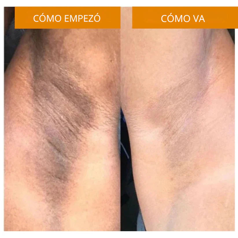 🧼 Pack de 2 Jabones Iluminadores de Cúrcuma por solo S/69