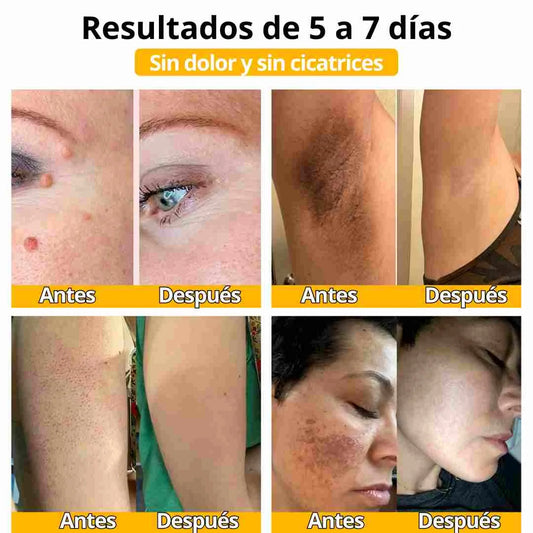 ABEJA DOLORES
