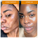 🧼 Pack de 2 Jabones Iluminadores de Cúrcuma por solo S/69